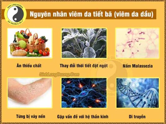 nguyen nhan gay viem da tiet ba nhon viem da dau