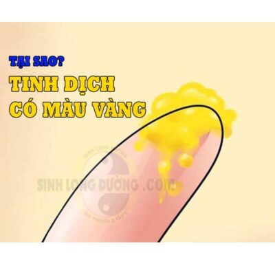 Tinh Dich Co Mau Vang Co Sao Khong
