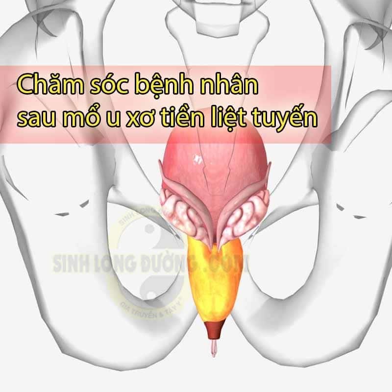 Cach Cham Soc Benh Nhan Sau Mo U Xo Tien Liet Tuyen