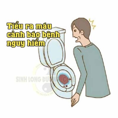Tieu Buot Tieu Ra Mau O Nam Gioi La Benh Gi