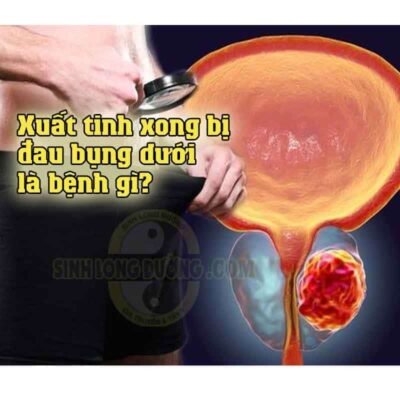 Xuat Tinh Xong Bi Dau Bung Duoi La Benh Gi